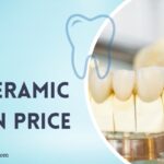 All You Need To Know About Full Ceramic Crowns and Their Cost