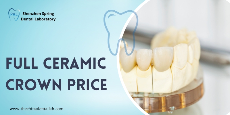 All You Need To Know About Full Ceramic Crowns and Their Cost