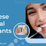 Finding the Best Dental Implants in China: Tips and Tricks