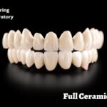 Everything You Need To Know About Full Ceramic Crown Price and Its Structure