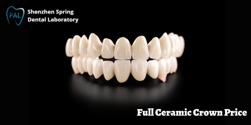 Everything You Need To Know About Full Ceramic Crown Price and Its Structure
